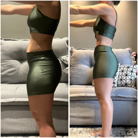 Antes e depois — resultado real de aluna do Protocolo